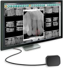 Digital Radiography Digital Radiography